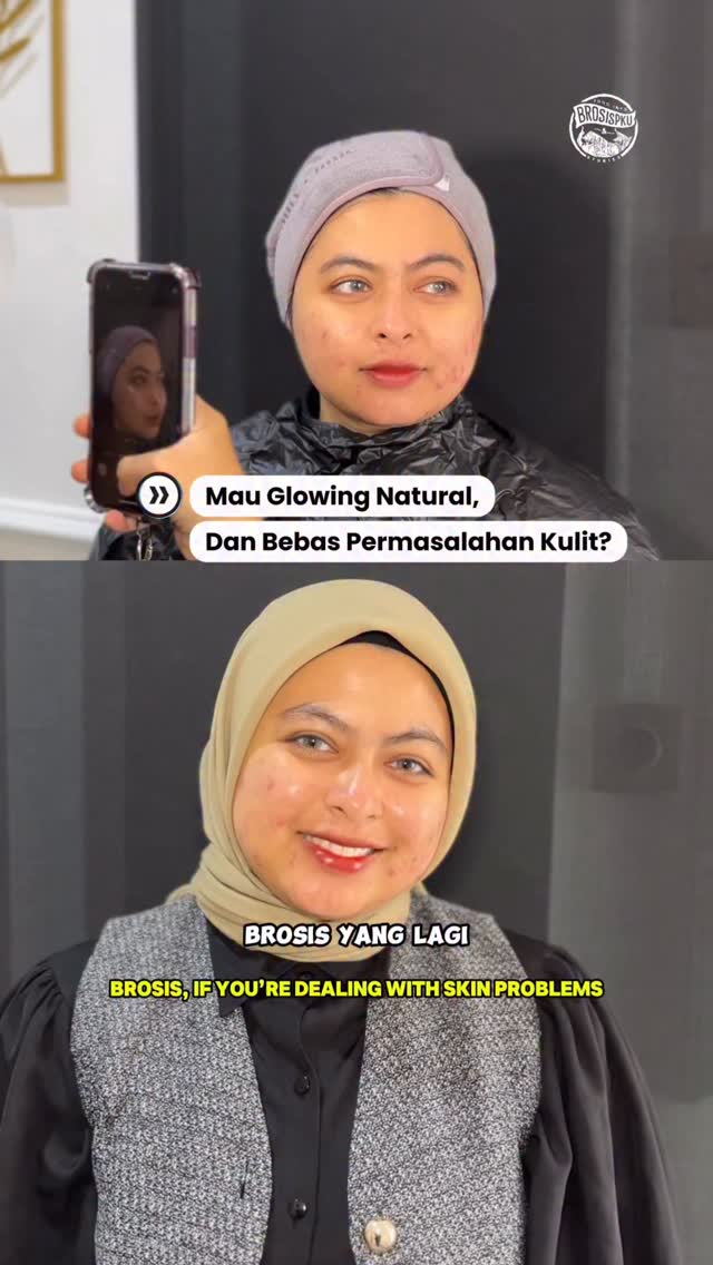 Raih Kulit Glowing di Beryl Beauty Clinic Pekanbaru